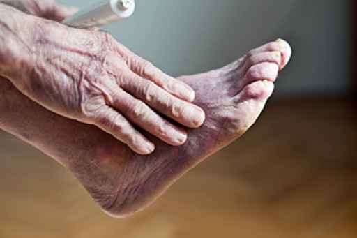 What Causes Poor Foot Circulation?