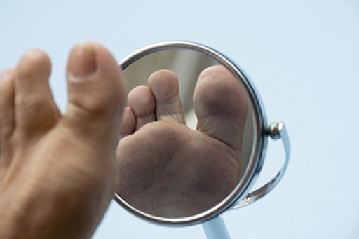 Different Types of Open Foot Wounds