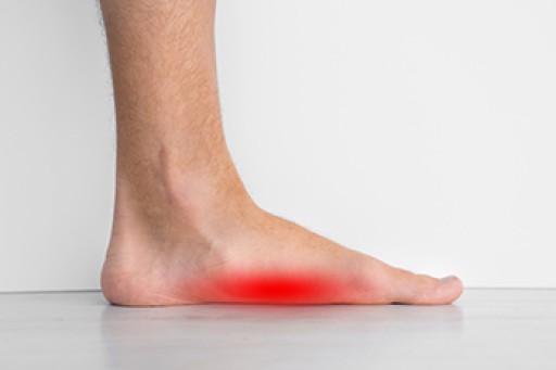 Flatfoot