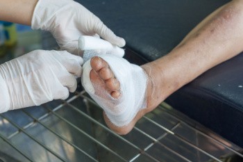 Common Foot Problems Caused by Diabetes