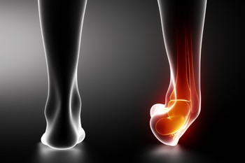 When a Foot Fracture Is Not Just an Ankle Sprain